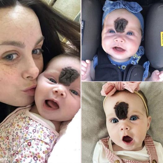 PARENTS KEPT THEIR BABY HIDDEN TO SHIELD HER FROM PEOPLE’S CURIOUS LOOKS. NOW, AT THE AGE OF 2, SHE LOOKS BEAUTIFUL.